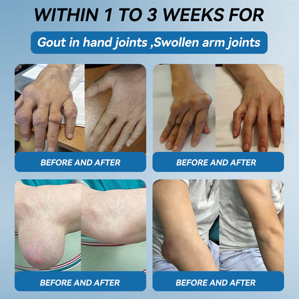 BPC-157 Joint Healing Cream🦴Treats Arthritis, Neuropathy, Rheumatism, Sports Injuries & More🦵